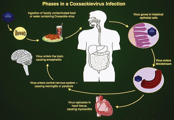 腸病毒嘴破可以擦口內膏嗎？