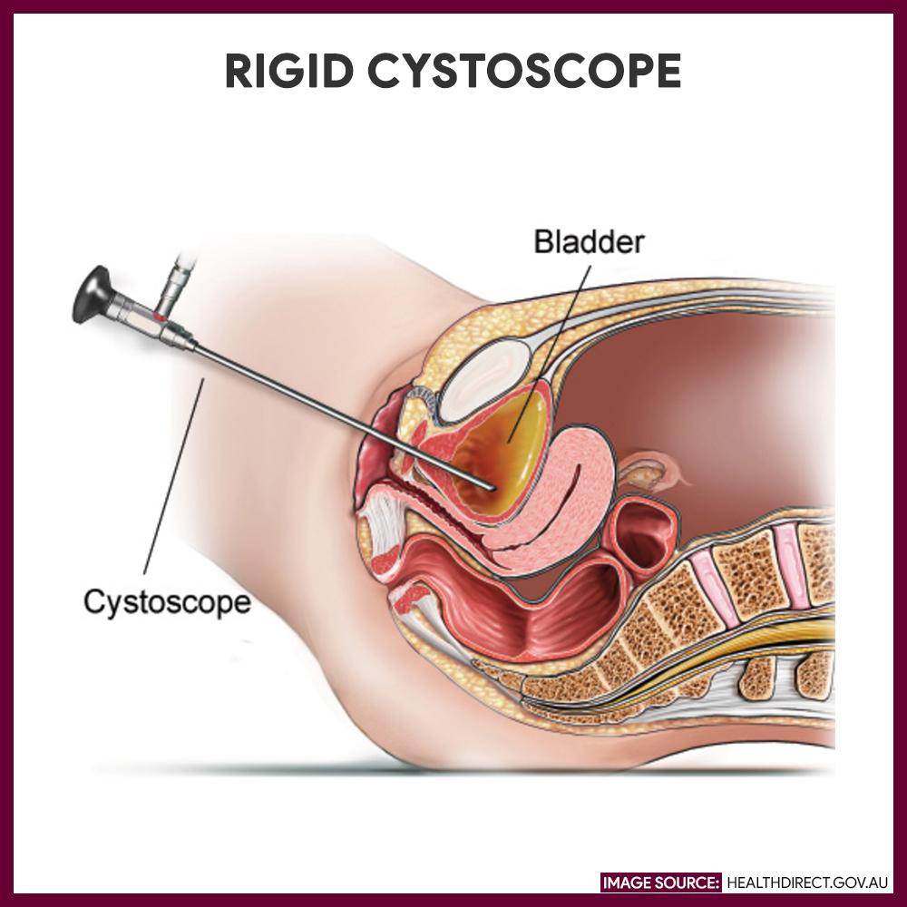 膀胱鏡幾錢？