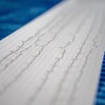 心電圖可以看出心律不整嗎？