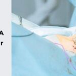 膽囊切除有什麼後遺症？