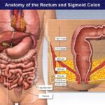 直腸發炎有什麼症狀？